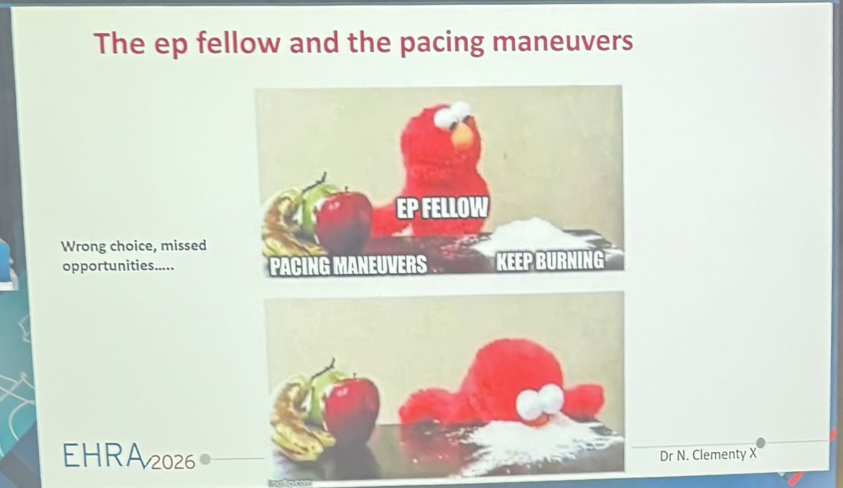 Dr_Ahmed_Ammar's tweet image. Back to Basic Electrophysiology 

Nice educational case and discussion of AVRT by @AndreaSarkozy at #EHRA26 

#EPeeps