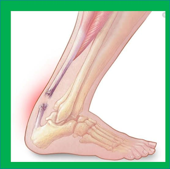 ali wincheste͙r 🍊 tweet media