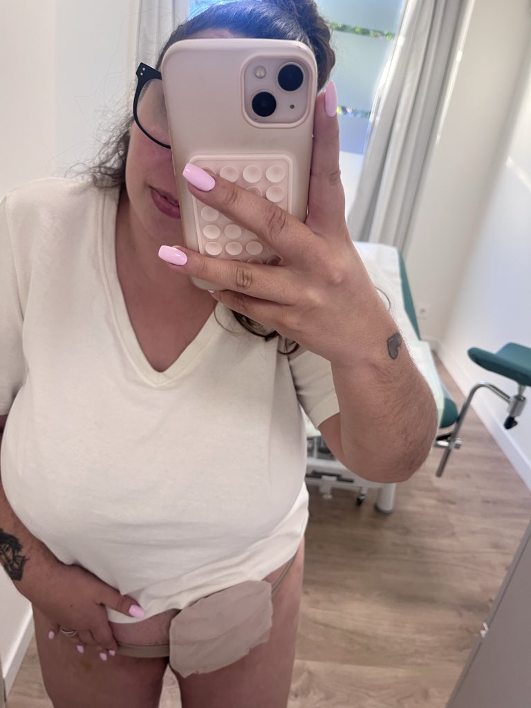 Iris Torrente | Ileostomia & inmunomediadas tweet media