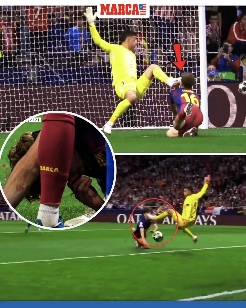 MARCAinENGLISH's tweet image. 🚨 Fermín López took a brutal kick to the face from Atlético keeper Juan Musso—breaking his nose and leaving him bleeding—but no penalty was given 😳

#UCL #ChampionsLeague #Barcelona