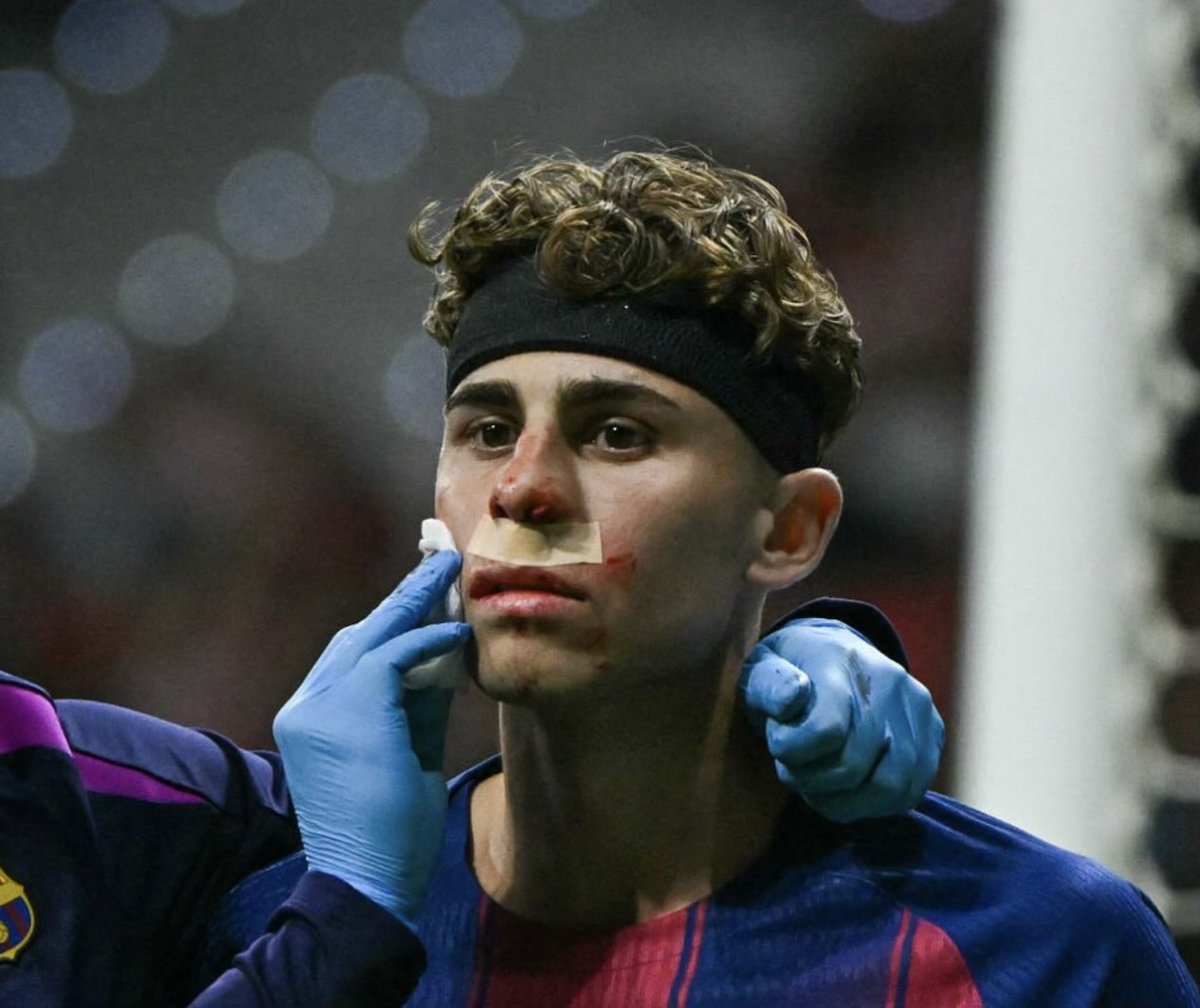 li ²⁴ tweet media