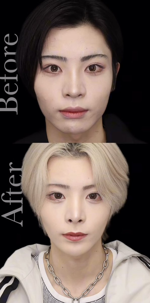 みょん◡̈【輪郭3点+目頭目尻タレ目DT中🏥】整形匿名タレコミ質問募集中 tweet media