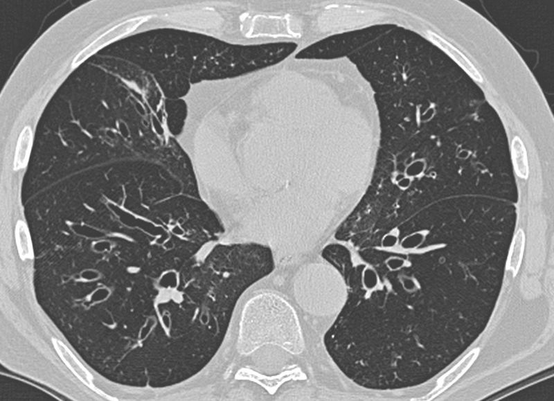 James D Chalmers tweet media