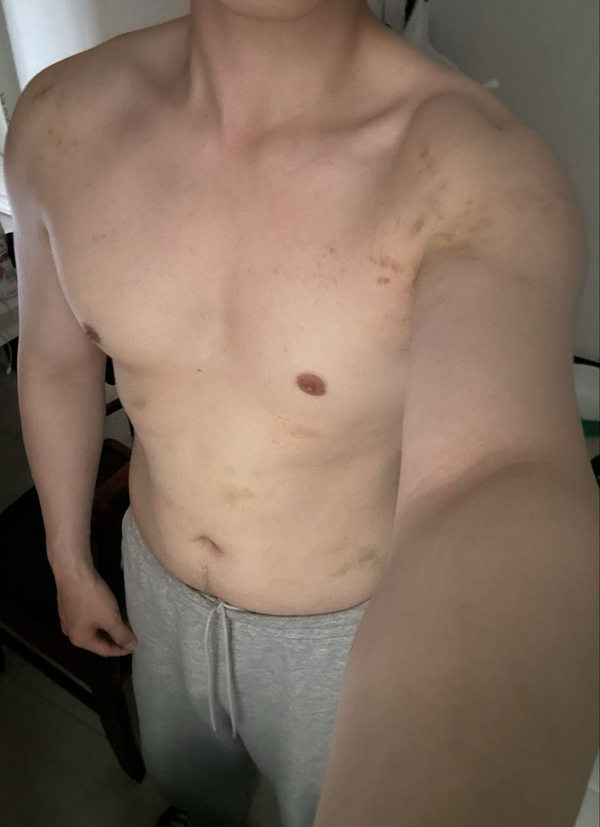 kkkk0916 tweet media