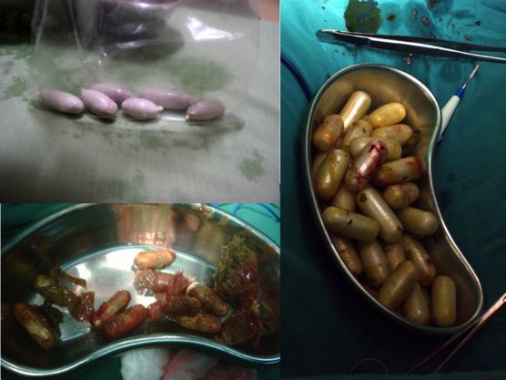 ྀིྀ bleu. tweet media