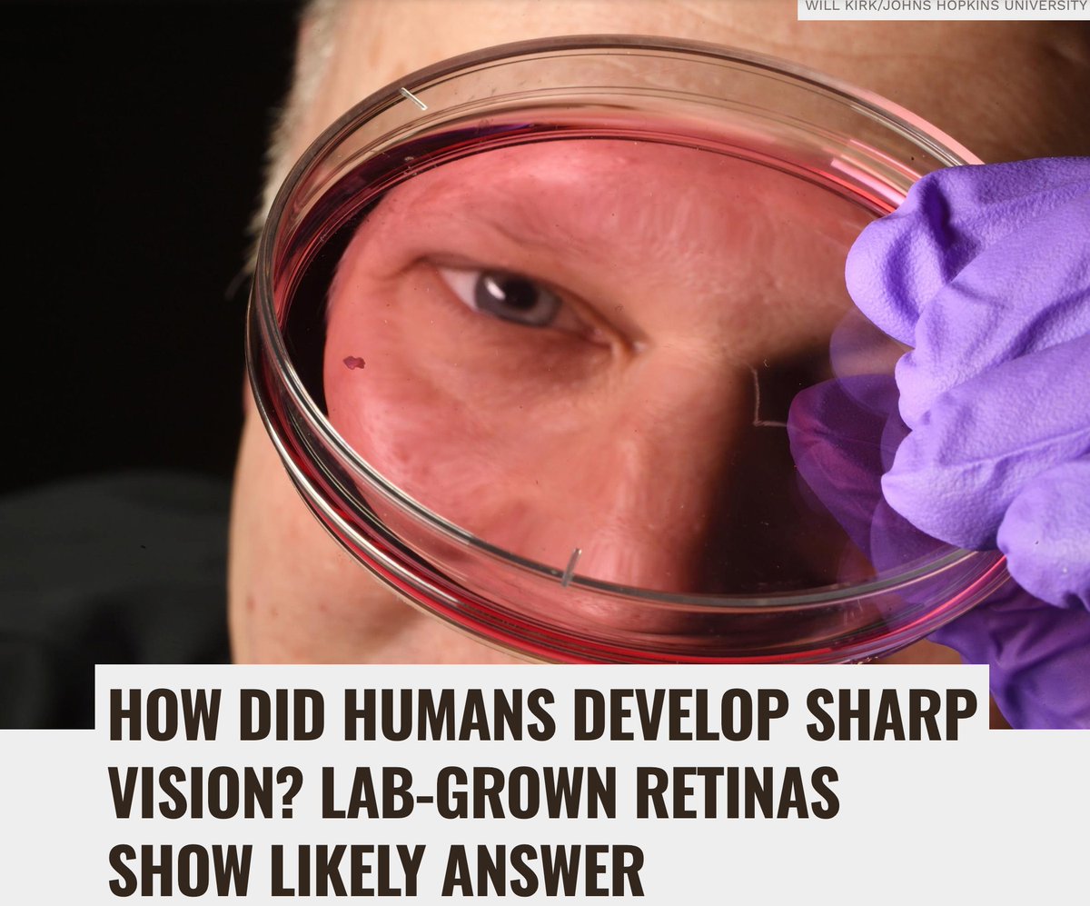 lowmegatron's tweet image. Thyroid hormone and vitamin A are needed for the development of the visual system.

They are essential for the differentiation of cones. Cones are the eye’s color-detecting cells, helping us see fine detail and distinguish blue, red, and green light.

Cell research showed that