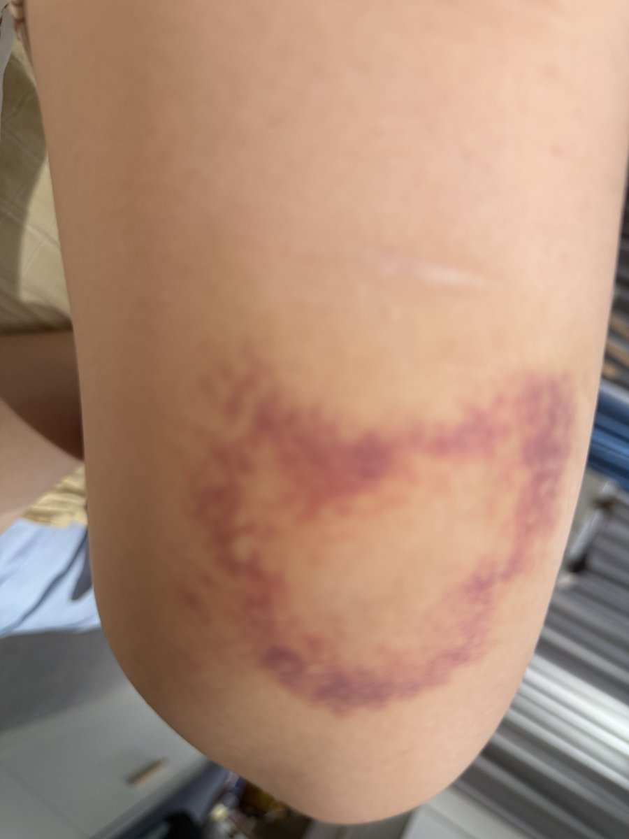 小灵草(转生互fo版) tweet media