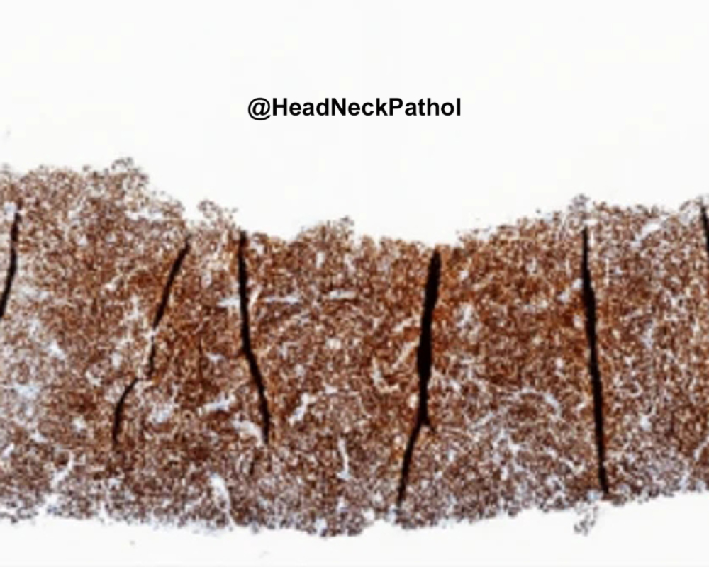 Head Neck Pathol tweet media
