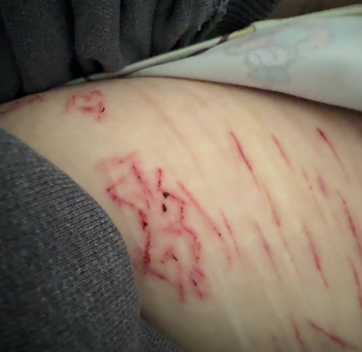 spaz of shedtwt tweet media