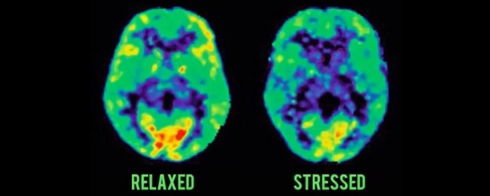 High cortisol is destroying your productivity. 7 natural ways to solve that.