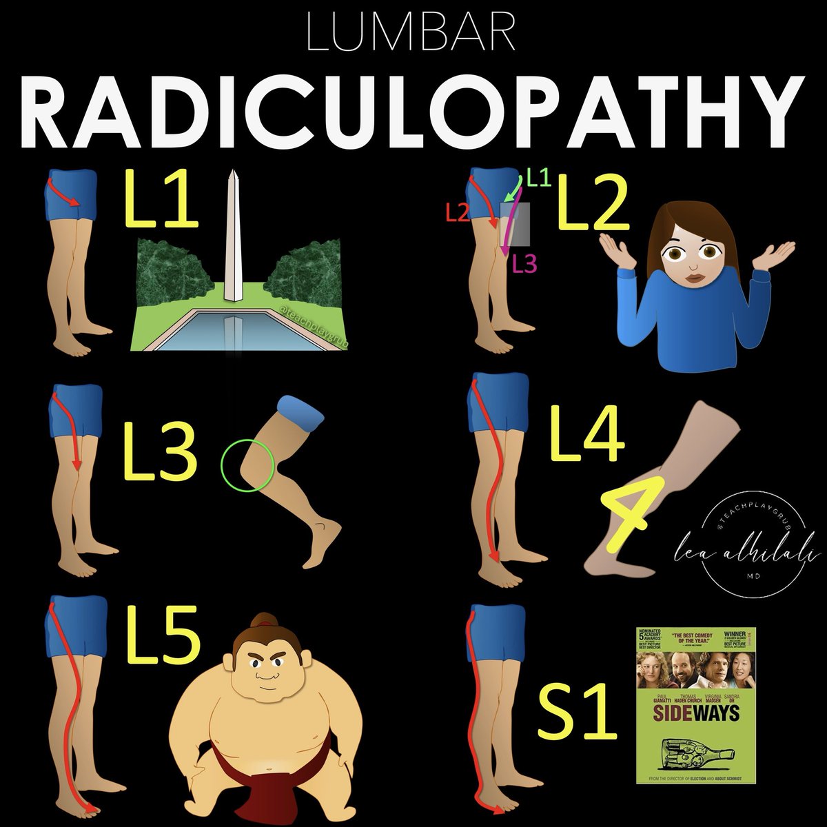 teachplaygrub's tweet photo. “Tell me where it hurts.”
 
How back pain radiates can tell you where the lesion is—if you know where to look!
 
Do YOU know where to look?
 
Here’s how to remember the lumbar radicular pain distributions!
 
Keep this cheat sheet as a BACKUP for when you are dealing with BACK pain!
 
➡️L1
🔸L1 radiates to the groin
🔸Remember that b/c the number 1 is, well, um…phallic. So phallic number 1 radiates to the groin.
 
➡️L2
🔸L2 radiates to thigh
🔸Two is the number between 1 and 3, so the distribution of L2 is between the distributions of L1 and L3—and between the groin (L1) and knee (L3) is the thigh.
 
➡️L3
🔸L3 radiates to the knee
🔸Remember L3 is to the knee—easy, it rhymes!
 
➡️L4
🔸L4 radiates to the calf.
🔸Remember this bc the number 4 looks like the calf, 🔸Top part of the 4 looking like a bulging gastroc & the bottom part of the four is the rest of the calf connecting to the ankle.
 
➡️L5
🔸L5 radiates to the big toe.
🔸Remember the little rhyme “Five is to the big guy!”
🔸L5 is also foot drop. Remember big guys are heavy, and heavy gravity = drop.
 
➡️S1
🔸S1 radiates to the side of the foot.
🔸Remember this because both S1 and Side start w/S.
 
So now you know where in the lumbar spine to a look when a patient tells you the pain radiates down their leg!
 
🚨Remember, there are many variations & this is just a starting guide🚨 
 
But hopefully now remembering the lumbar radicular distributions won’t be a pain in the backside!