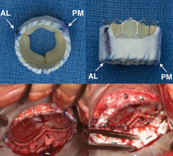 Mayo Clinic Cardiac Surgery tweet media