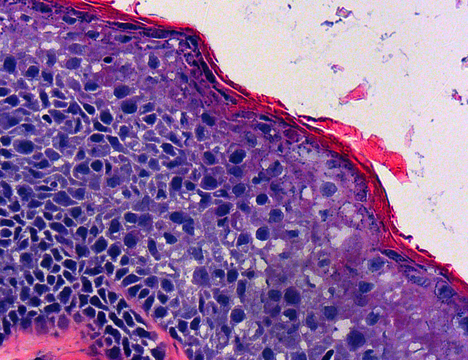 Science Translational Medicine tweet media