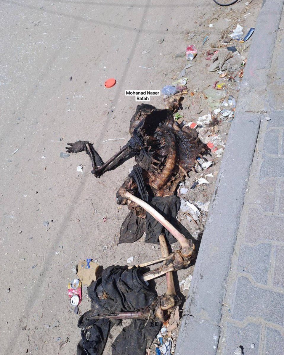 DON'T STOP TALKING ABOUT GAZA 💔