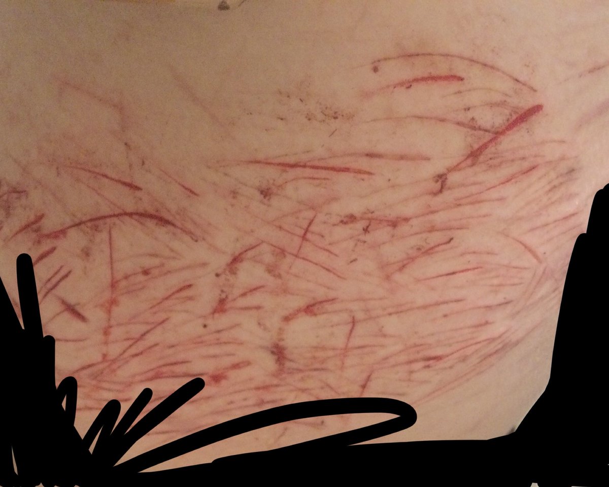 MiziSua69's tweet image. FUCK OW I JUST SPRAYED A FUCKINH HOSE ON THESE AND IT HURT SO FUCKIN BAD OWOWOWOW