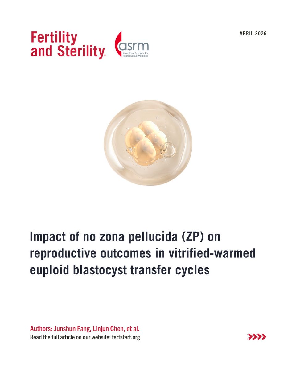 FertStert's tweet image. Impact of no zona pellucida on reproductive outcomes in vitrified-warmed euploid blastocyst transfer cycles

Full text 👇
fertstert.org/article/S0015-…