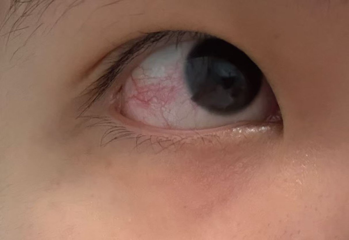 我的智齿可疼了 tweet media