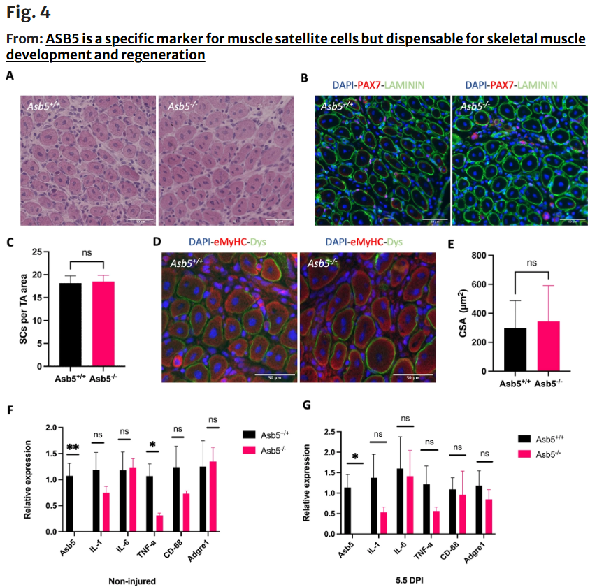 Check out Skeletal Muscle's Featured Article: 