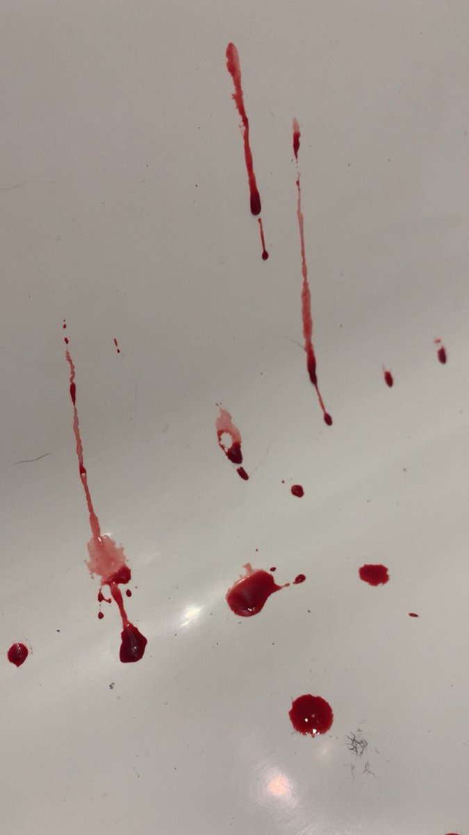 staysafe890's tweet image. I also have some photos of blood so i will post them as well BUT I MISS MY PRIME SO BAD 
(If anyone will see it you can slash flash in comments😝)
#shtwt #sh #blood #slashflashme