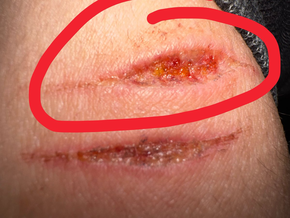 Tea Leaves // Hong Lu of shedtwt!! tweet media