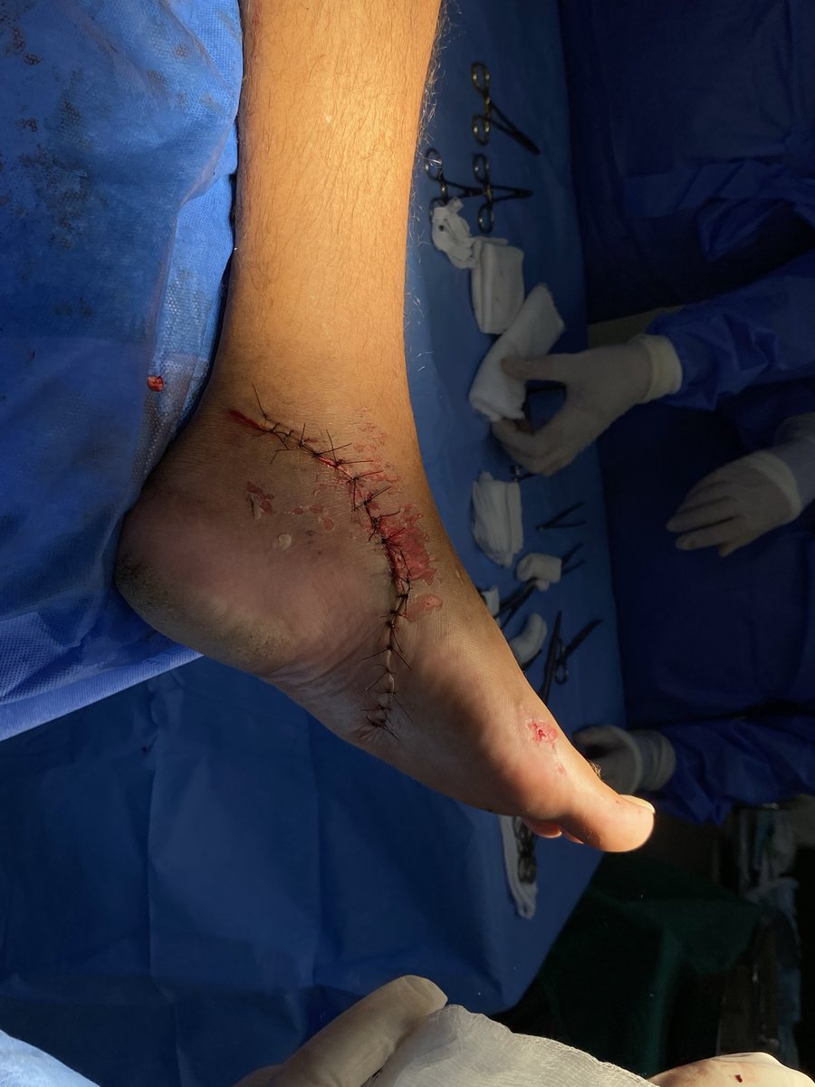 Ju⁷ ARIRANG tweet media