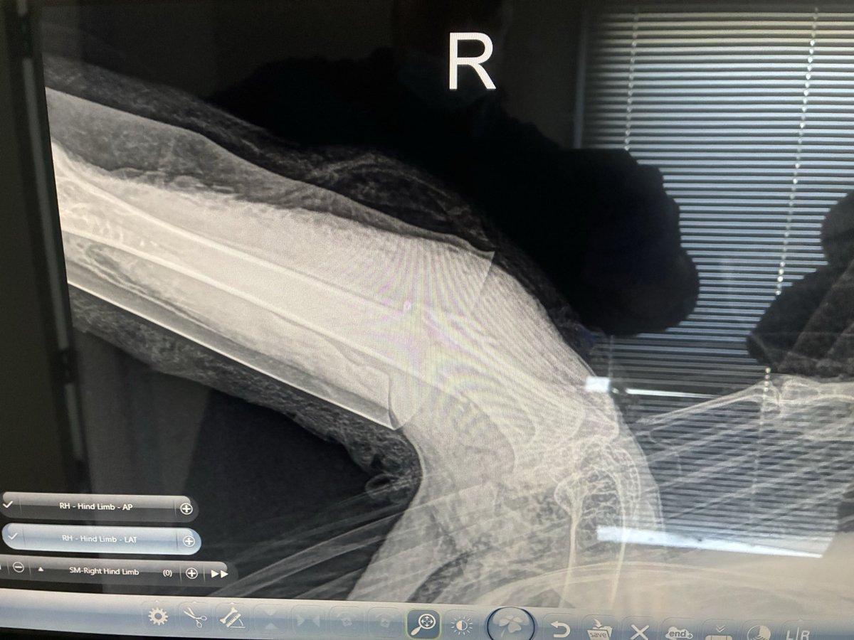 OWLRehab's tweet photo. Young bald eagle suffering from a broken leg and lead poisoning.
Help support birds like these by attending our Open House May 30th & 31st learn more here: https://t.co/IRpfApzQmM
#OWLrehab #RescueRehabRelease #OWLFundraiser #RaptorRehabilitation #OWLOpenHouse #LeadPoisoned https://t.co/4L3J3GLi7v