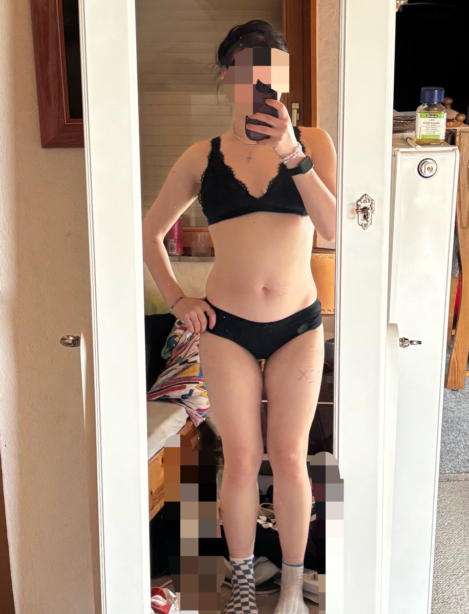 IwaHatesU's tweet image. Sometimes I feel like there is nowhere near enough of a difference. I have to kill who I used to be.
#edtwt #weightloss 

Bmi 33 -&amp;gt; Bmi 20