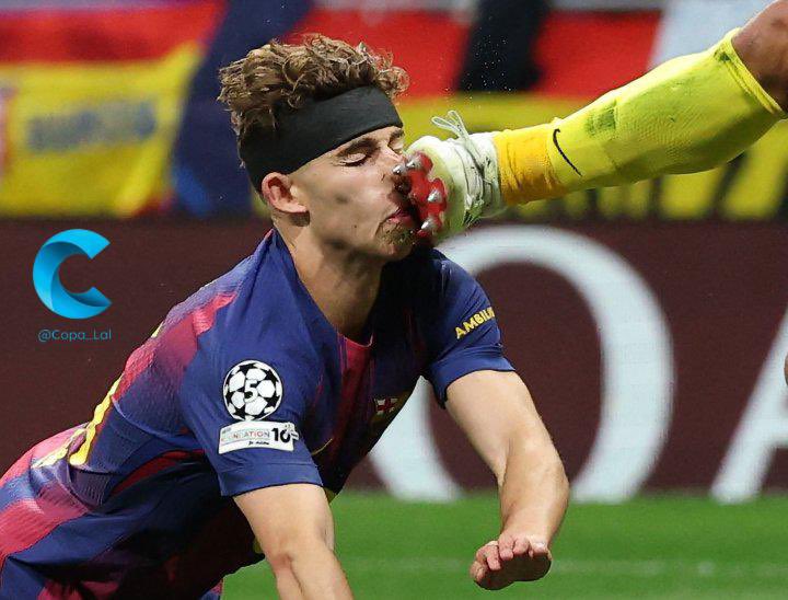 يعقوب العوضي tweet media