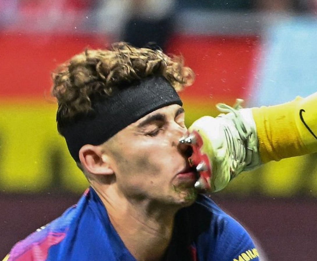 🥷🏼 tweet media