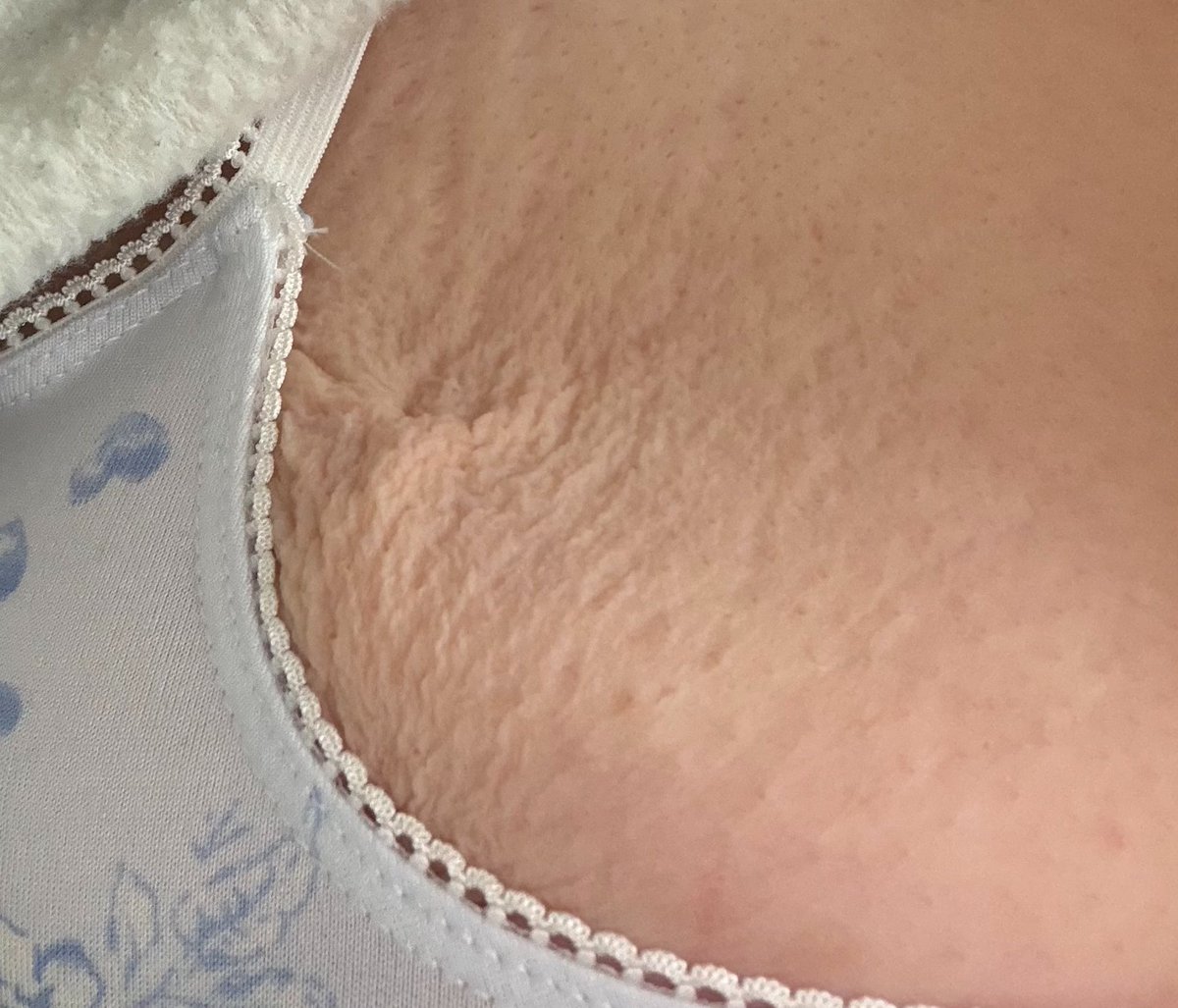 𖦹 -96lbs tweet media