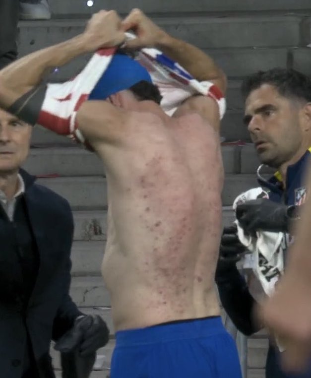 TeddyBellingham's tweet photo. Did Ruggeri’s shirt change just expose Atletico Madrid and Diego Simeone’s dirty secret? https://t.co/sI1972JvrI