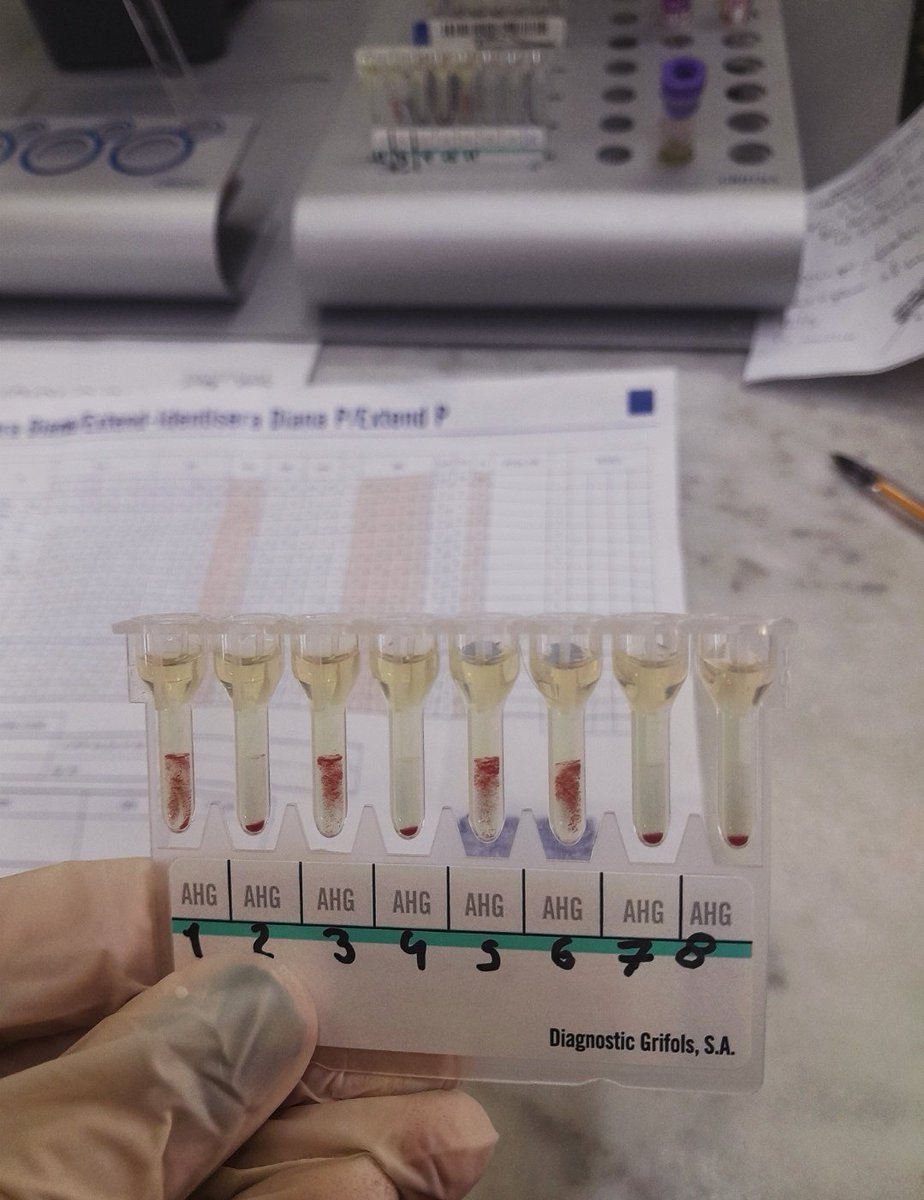panquequitou's tweet photo. hola me unen a su comunidad por favor y gracias 
tengo que dejar de patear el final de histo!!
soy técnica en hemoterapia e inmunohematología de fmed y estudio bioquímica en ffyb (UBA) 
#studytwt 🤧📚 https://t.co/WMrmRUVq1S