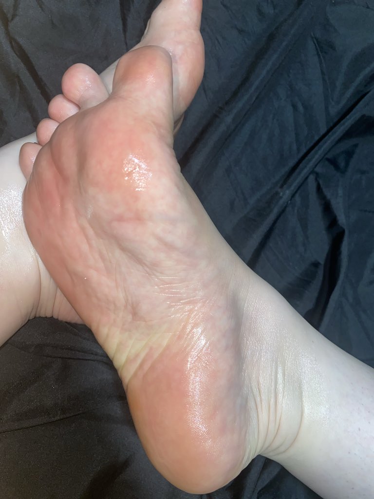 Cherrysteps tweet media