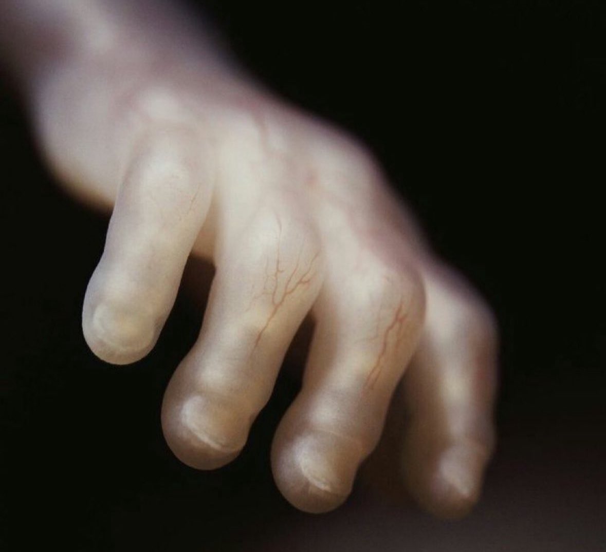 Anna Lulis tweet media