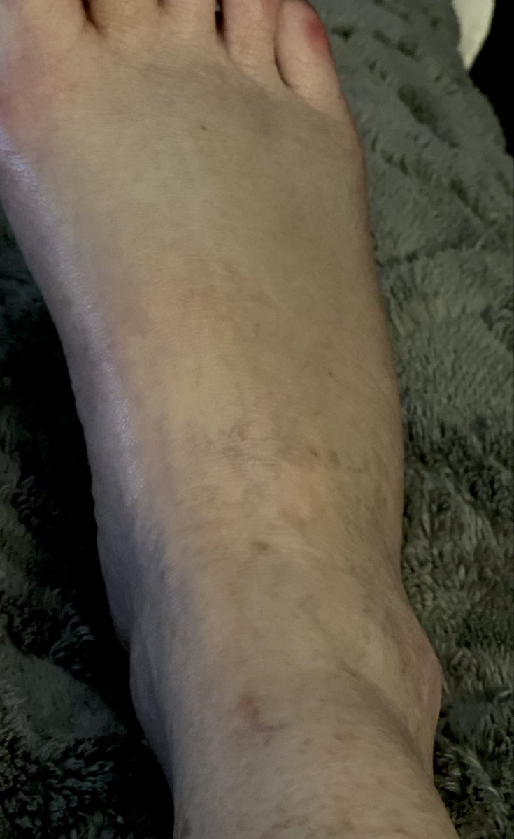 Becky Ancira Robertson tweet media