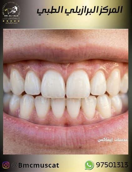 المركز البرازيلي الطبي ( أسنان) مسقط 🇴🇲 tweet media