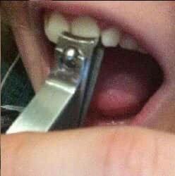 ╱╳╲ tweet media