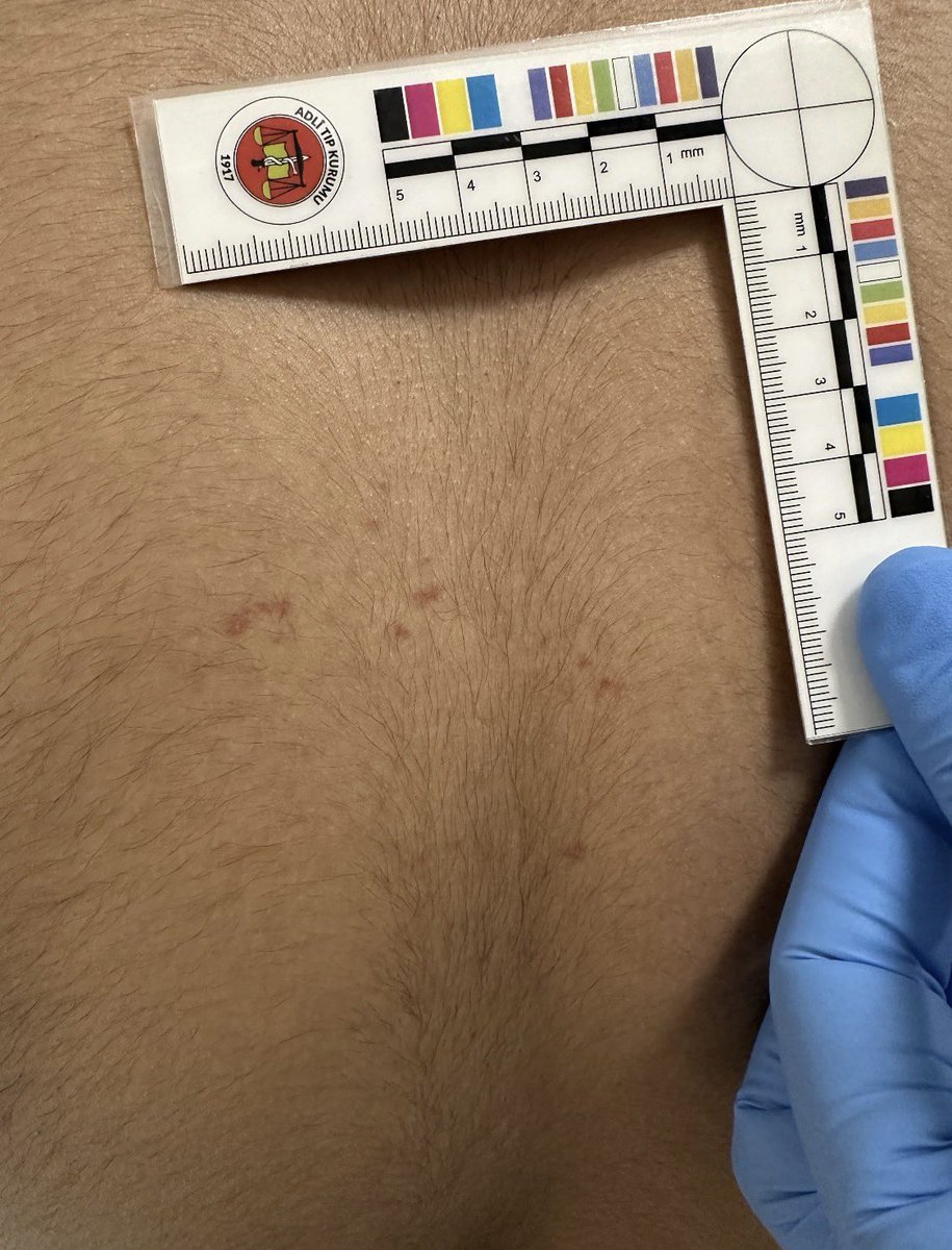 Tuncay Beşikçi tweet media