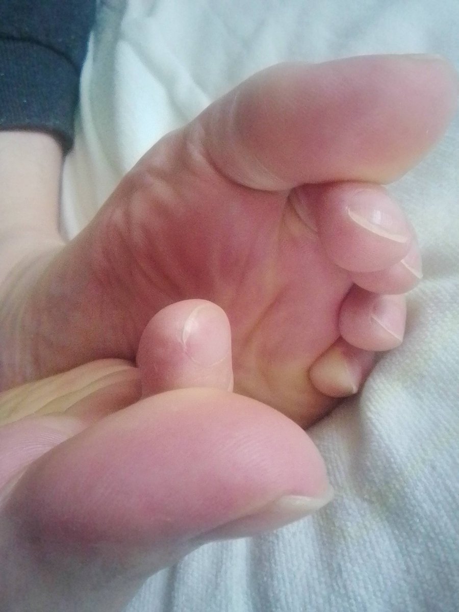 ゆうま🦁 tweet media