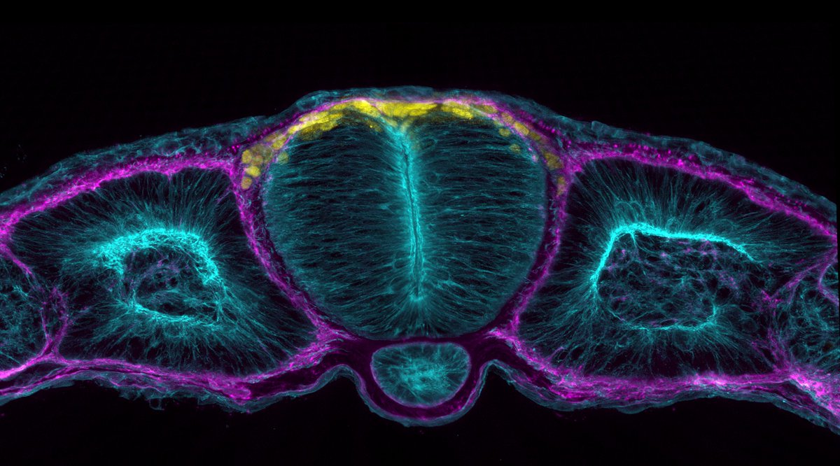 shishenyxx's tweet photo. Unlocking Secrets of Human Development: How Early Nerve Cell Choices Shape the Peripheral Nervous System https://t.co/Si6vaUpmrP https://t.co/1yCthzWtxp