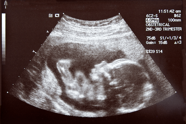 LifeNews.com tweet media