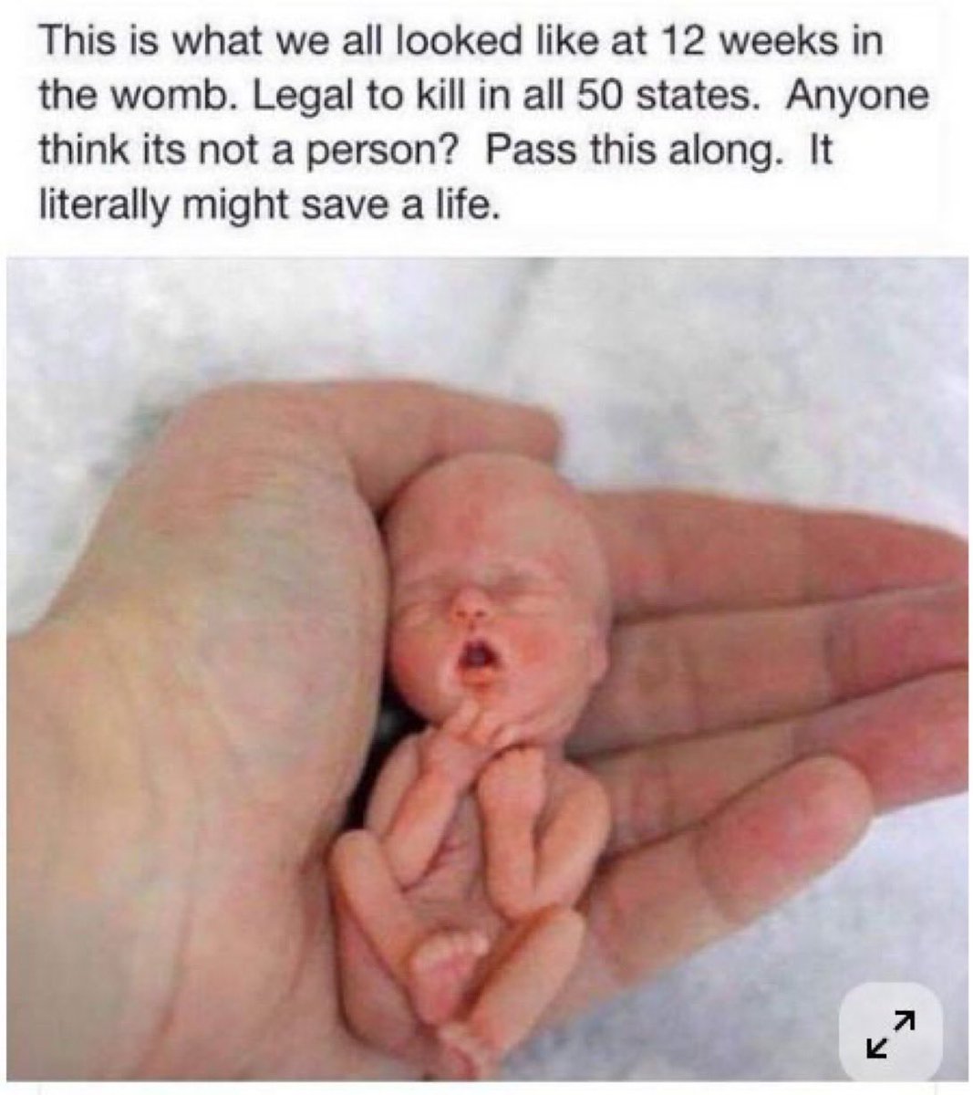 🇺🇸Bob “GoArmy” Vasquez🇺🇸 tweet media