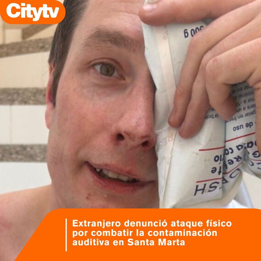 Canal Citytv tweet media