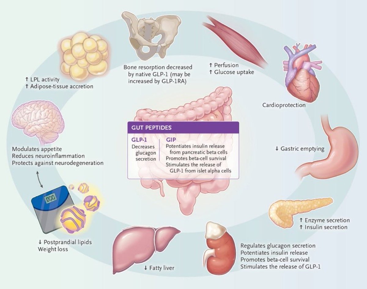 ApoThera's tweet photo. GLP-1 Receptor Agonists | NEJM
https://t.co/393dga99O4
#usmlestep1 #USMLE #EtudiantEnMedecine #InternalMedicine #diabetes #Cardiologie #Cardiologia #MedicinaFamilia #MedicinaInterna #MedicinaInternaPT #MédecineInterne #MedStudentTwitter #medicinale #FuturDoc #Médecine #Mounjaro https://t.co/N0rxYajlh1
