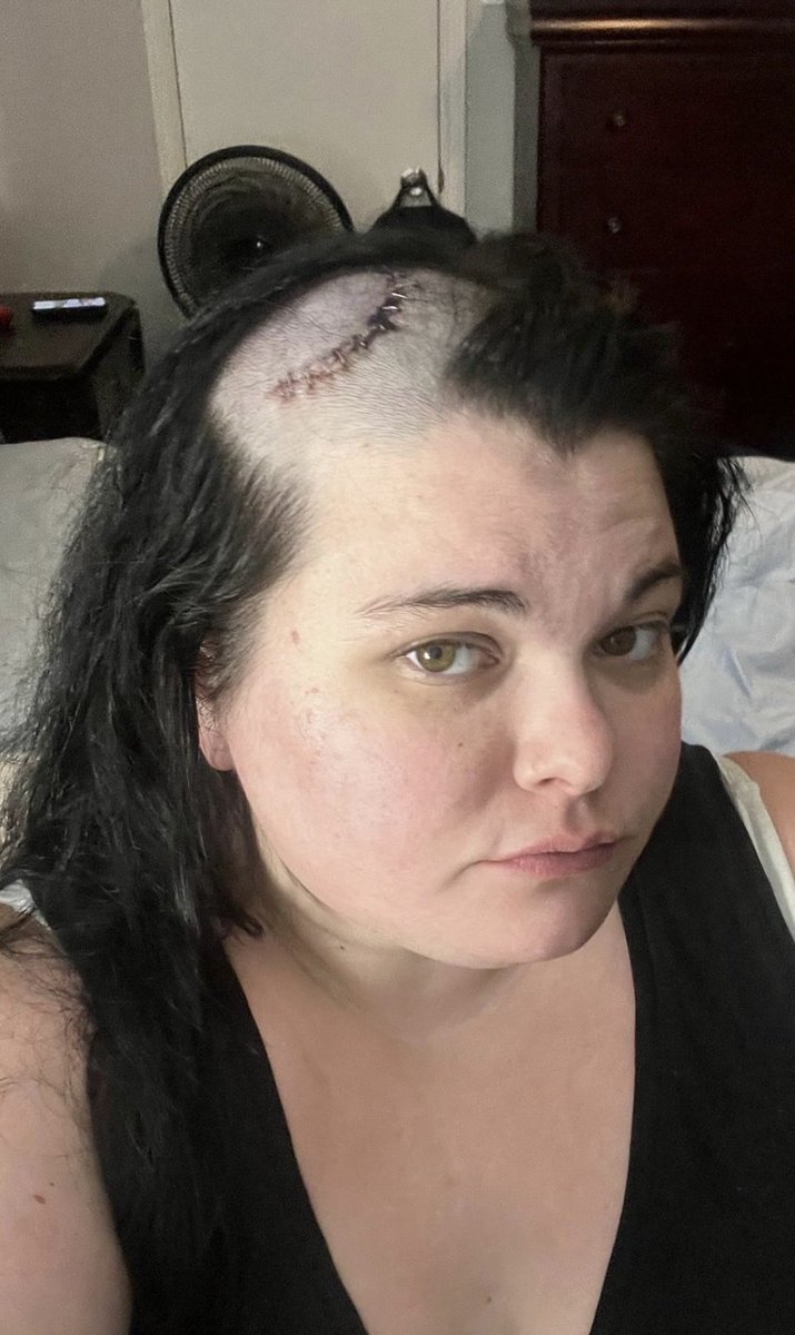 RichardGuasto's tweet image. Please share to help
Kaitlyn get her 12th brain surgery❤️
gofund.me/eedc473da #share #support #gofundme  #instagood  #love #life #surgery