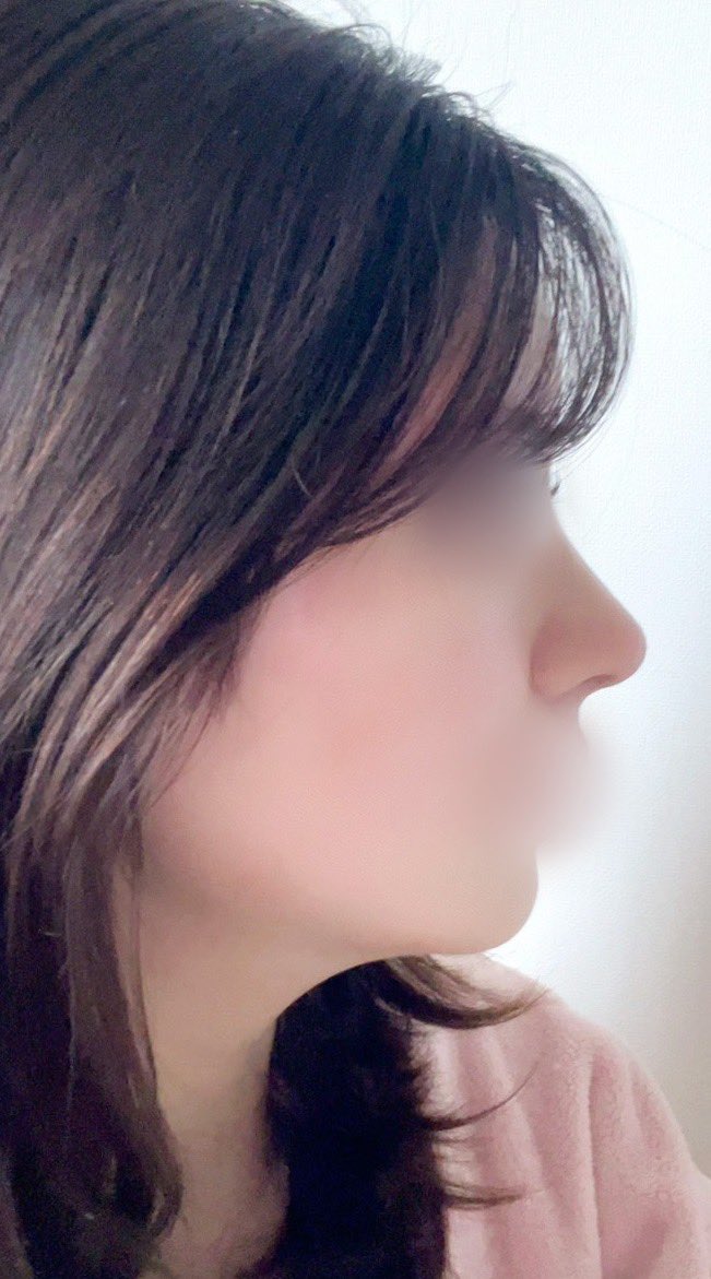 u 🇰🇷鼻フルDT中 tweet media