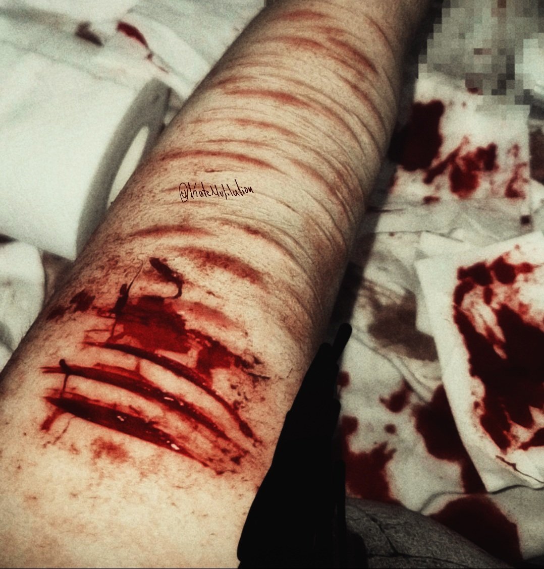 KateMutilation's tweet photo. #shtwt https://t.co/yijcXzUi50