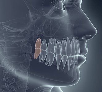 SmartScience's tweet photo. 🚨: Scientists reveal that stem cells harvested from extracted wisdom teeth could serve as “medical gold” for treating Parkinson’s, Alzheimer’s, and other serious diseases. https://t.co/tbmwVmmaWl