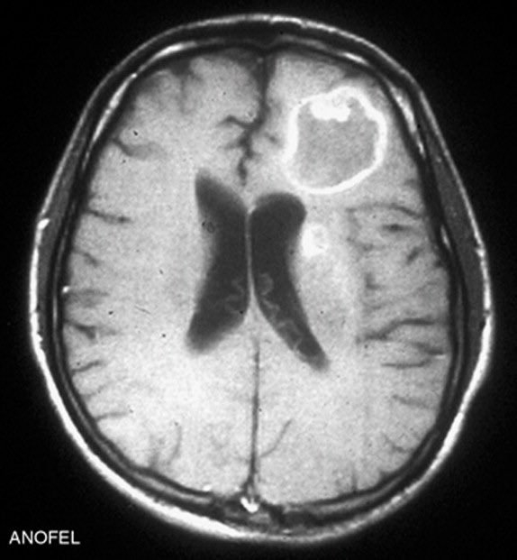 S.Enf.Infecciosas HRUM tweet media