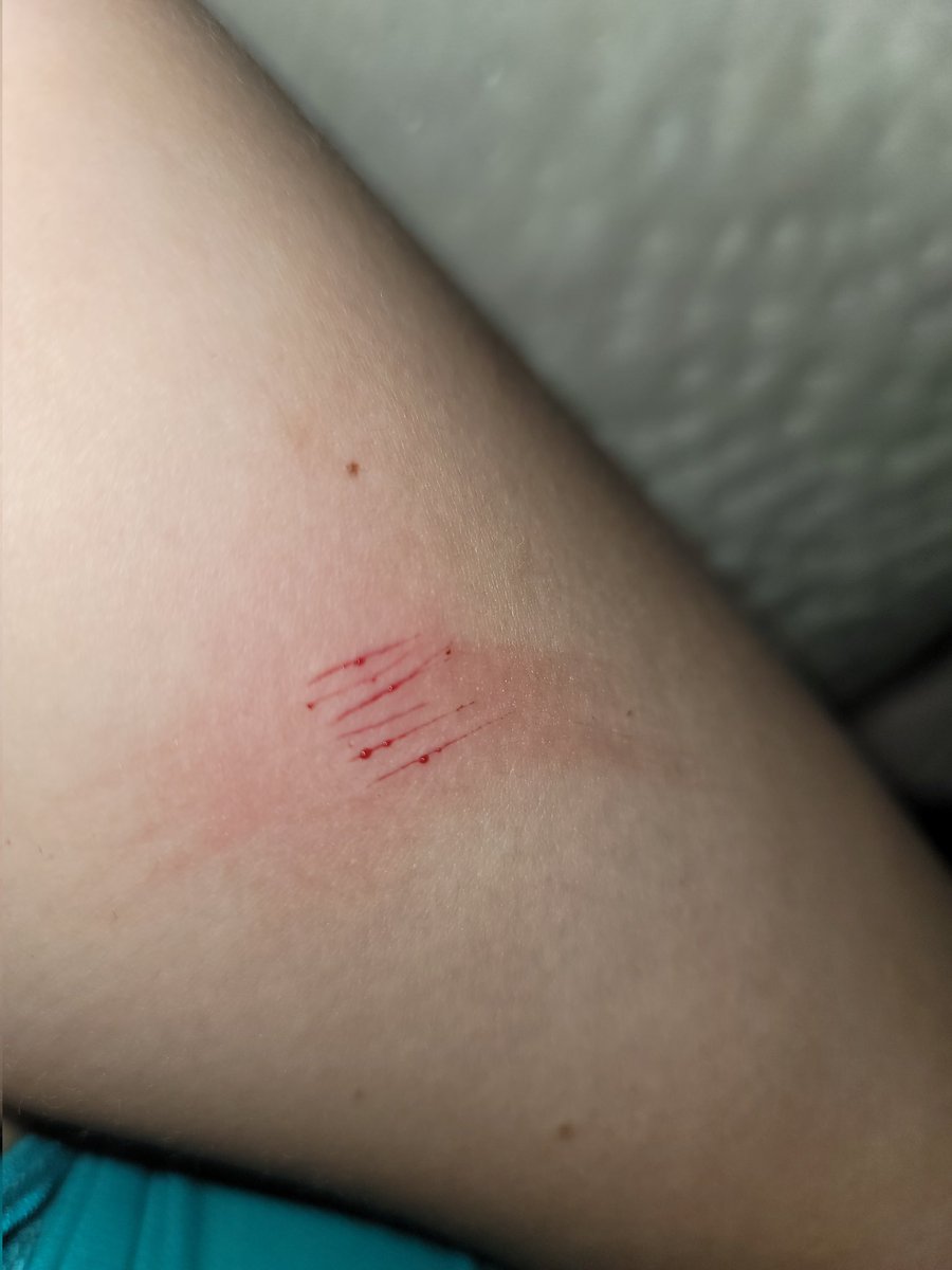 ʚ♡⃛ɞ Himiko Yumeno of Shtwt ˃ 𖥦 ˂ tweet media